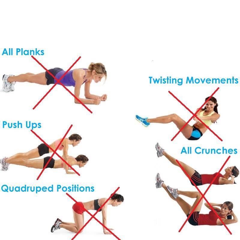 Ali lahko nosimo nosilko, če imamo diastazo rektusov (razmik trebušnih mišic) in kako?